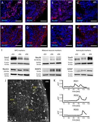 Induced pluripotent stem cell-derived <mark class="highlighted">brain organoids</mark> as potential human model system for chemotherapy induced CNS toxicity
